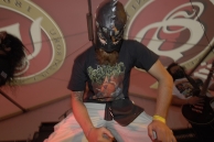 Urtikaria Anal